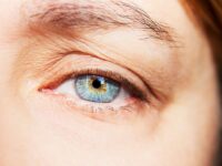 Eyelid Surgery